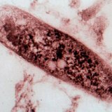 Симптомы и диагностика туберкулеза