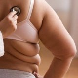 Лечение избыточного веса и ожирения