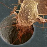 Основные причины возникновения рака