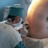 Техника выполнения спинальной анестезии