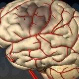 Атеросклероз сосудов головного мозга: симптомы, лечение