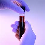 Биохимический анализ крови, нормативные показатели