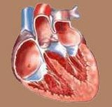 Заболевание сердца: стенокардия