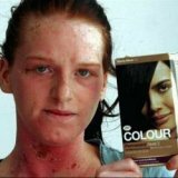 Аллергическая реакция на краску для волос