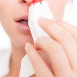Кровотечение из носа при беременности