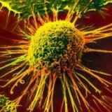 Применение гомеопатии в онкологии