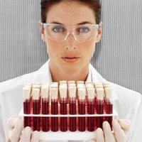 Анализ крови на половые гормоны