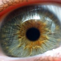 Заболевания сетчатки глаза