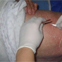 Гистологическое исследование кожи