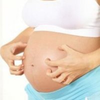 Зуд во время беременности
