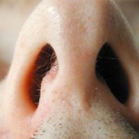 Искривление носовой перегородки