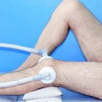 Лечение мениска дискоидного коленного сустава