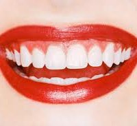 Где лучше отбеливать зубы – дома или в стоматологии?
