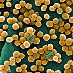 Бактерии кокки в мазке
