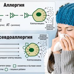 Псевдоаллергия: симптомы, причины и лечение