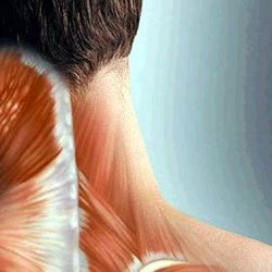 Спазмы шейных мышц. Причины и лечение