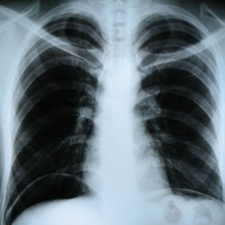 Не представляют ли рентгенологические просвечивания опасности для здоровья