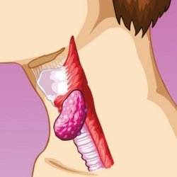 Причины и лечение комка в горле