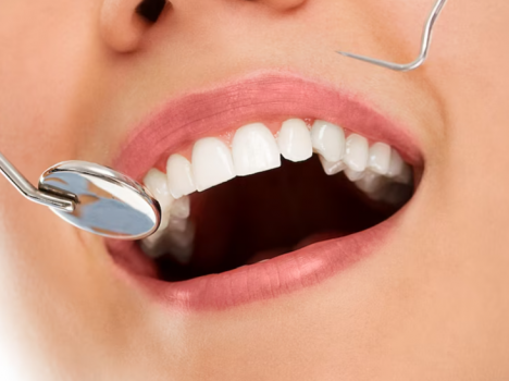 Как часто можно делать отбеливание зубов?