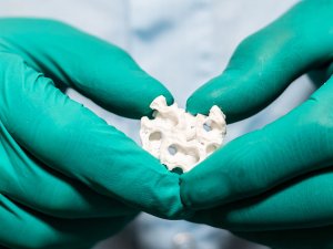 3D-биопечать для замены костной ткани